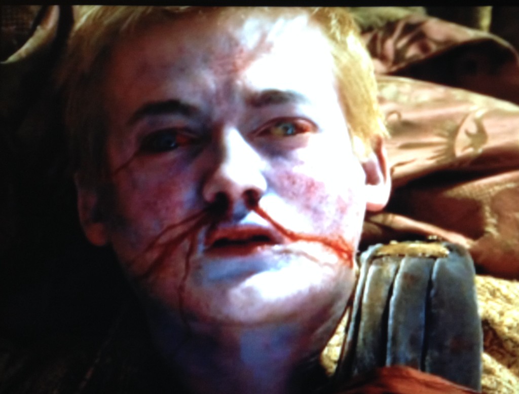 dead joffrey